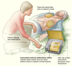 An Automatic External Defibrillator (AED) can save lives