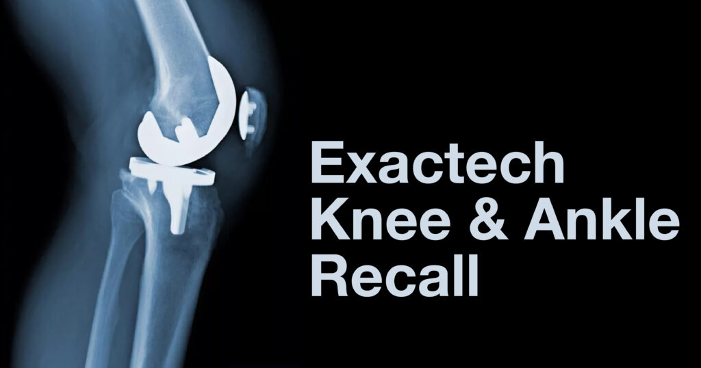exactech knee ankle recall